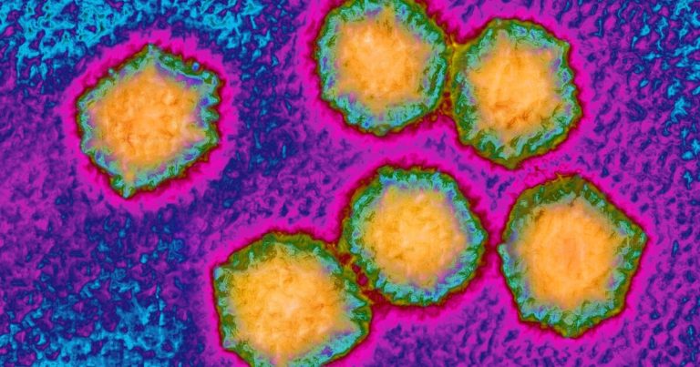 L.A. County investigating hepatitis A case at Beverly Hills Whole Foods